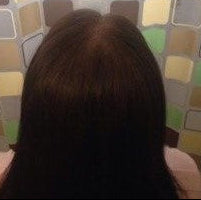After - "I can't believe the hair growth...its just amazing. My hair thinning has reduced all thanks to Yohana's products.."