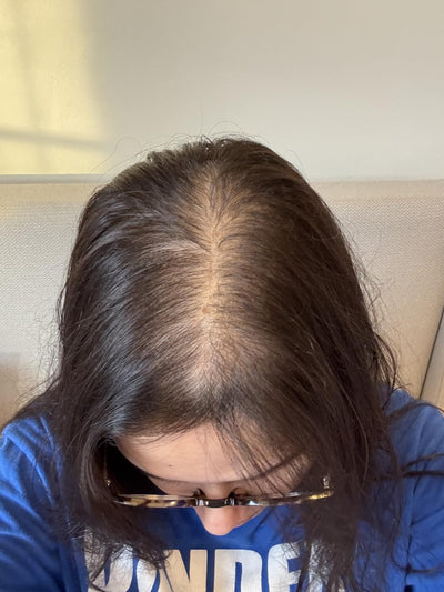Day 01