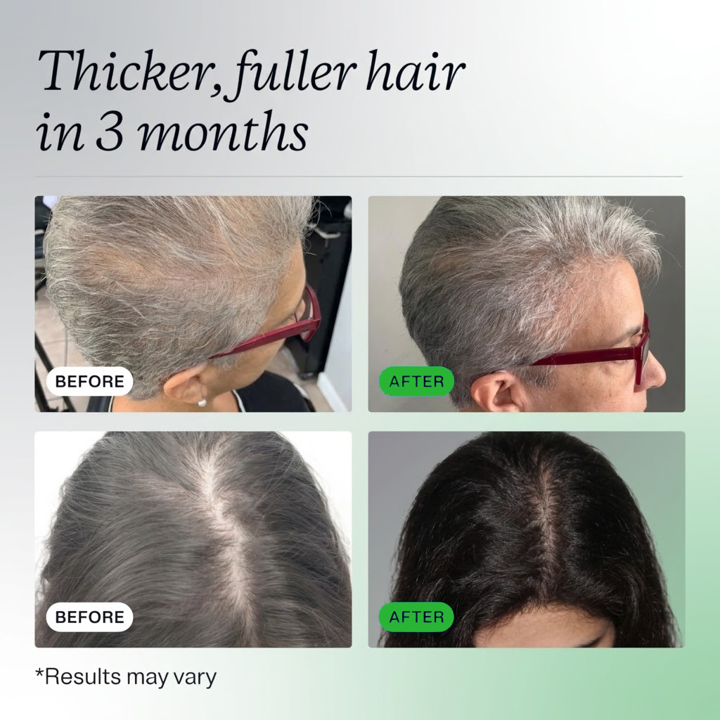 Before and after results from using Yohana's Hair Growth Serum