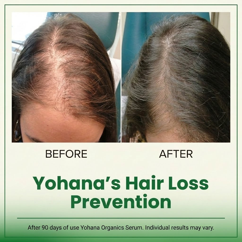 Woman applying Yohana's Hair Growth Serum to her scalp